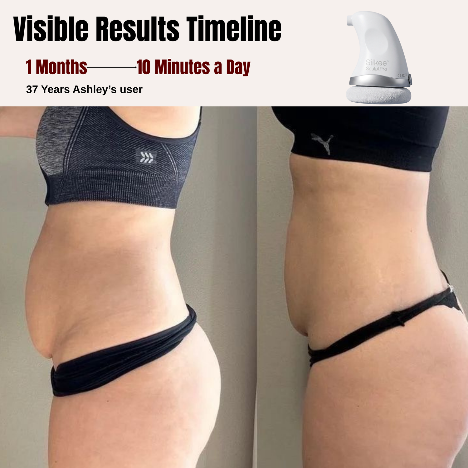 Silkee™ SculptPro – Postpartum Set